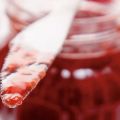 Μαρμελάδα φράουλας στα μικροκύματα
