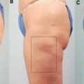 Εσείς ξέρετε τι είναι το body brushing;Η πιο[...]